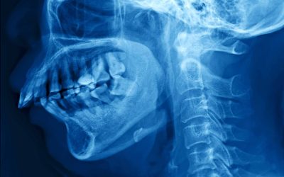 PT Research News: The effectiveness of physical therapy for the management of temporomandibular disorders